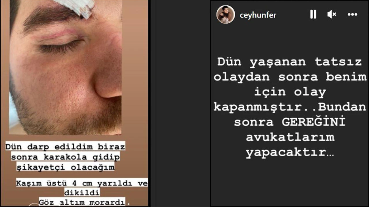 Seksenler'in Şahin'i Ceyhun Fersoy'a yumruklu saldırı! Hastanelik oldu